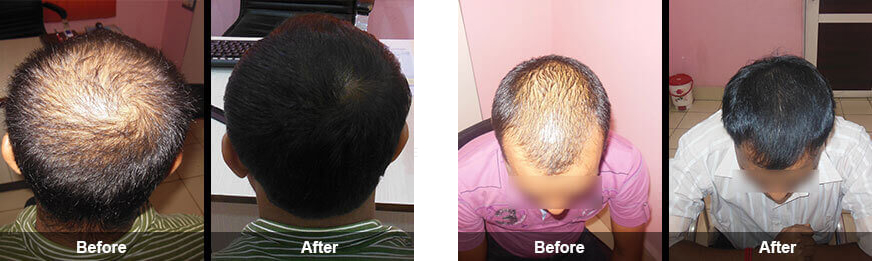Hair solutions-img Hair solutions