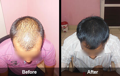 h4 Hair solutions