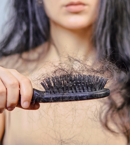 Hair Fall Treatment