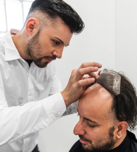 Non-Surgical Hair Replacement