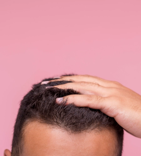 PRP Hair Loss Treatment