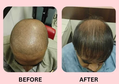 Hair Treatment