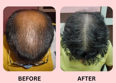 Hair Treatment