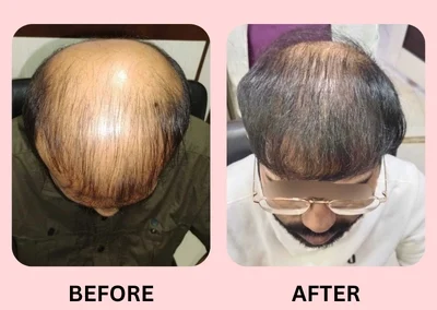 Hair Treatment
